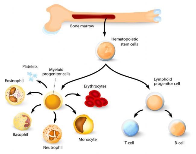 what_causes_mpns_main